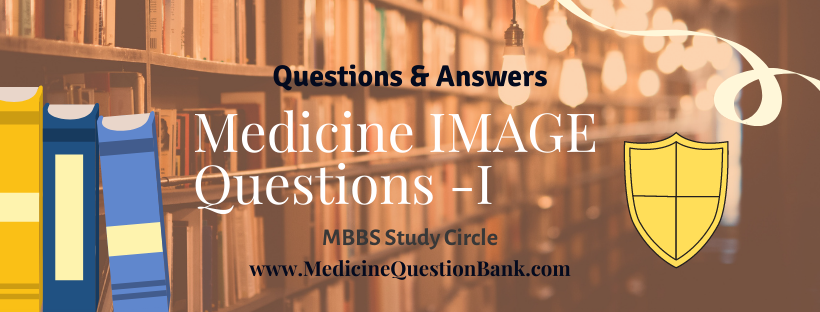 Medicine Question Bank