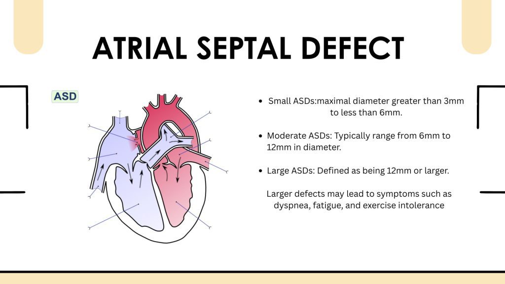 Infographic showing restrictive atrial septal defect with limited left-to-right shunting on echocardiography