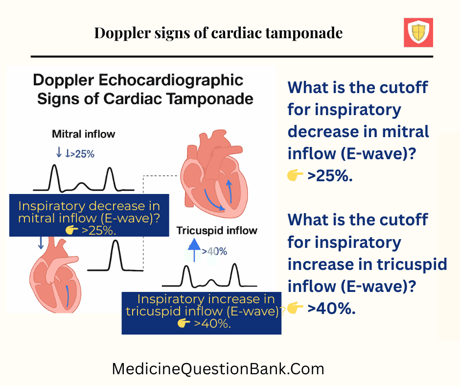 Doppler signs of cardiac tamponade- Pericardial effusion imaging,,Echocardiography in pericardial effusion,,CT scan pericardial effusion,,MRI pericardial effusion,,Chest X-ray pericardial effusion,,Cardiac tamponade echocardiography,,Right ventricular collapse echo,,Swinging heart pericardial effusion,,Water bottle heart chest X-ray,,Loculated pericardial effusion imaging