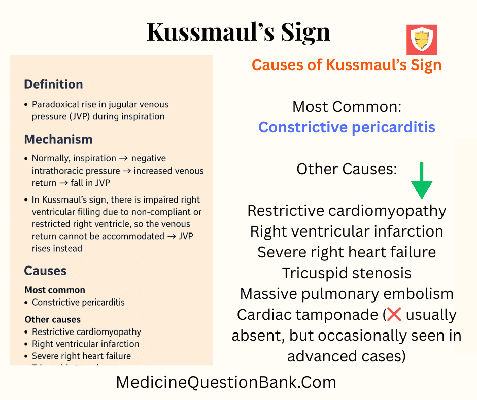 Kussmaul’s Sign