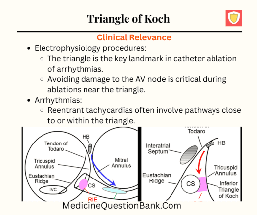 Triangle of Koch