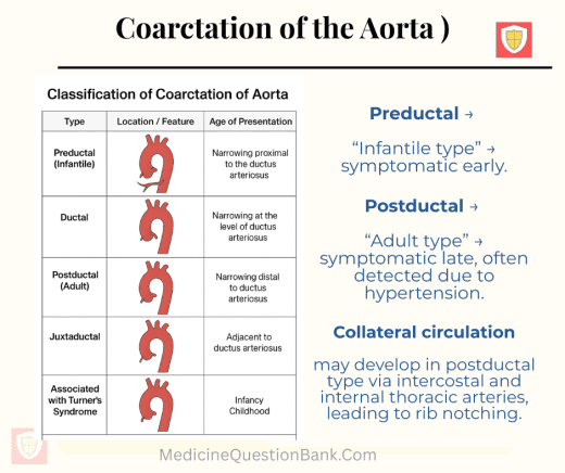 Coarctation of the Aorta