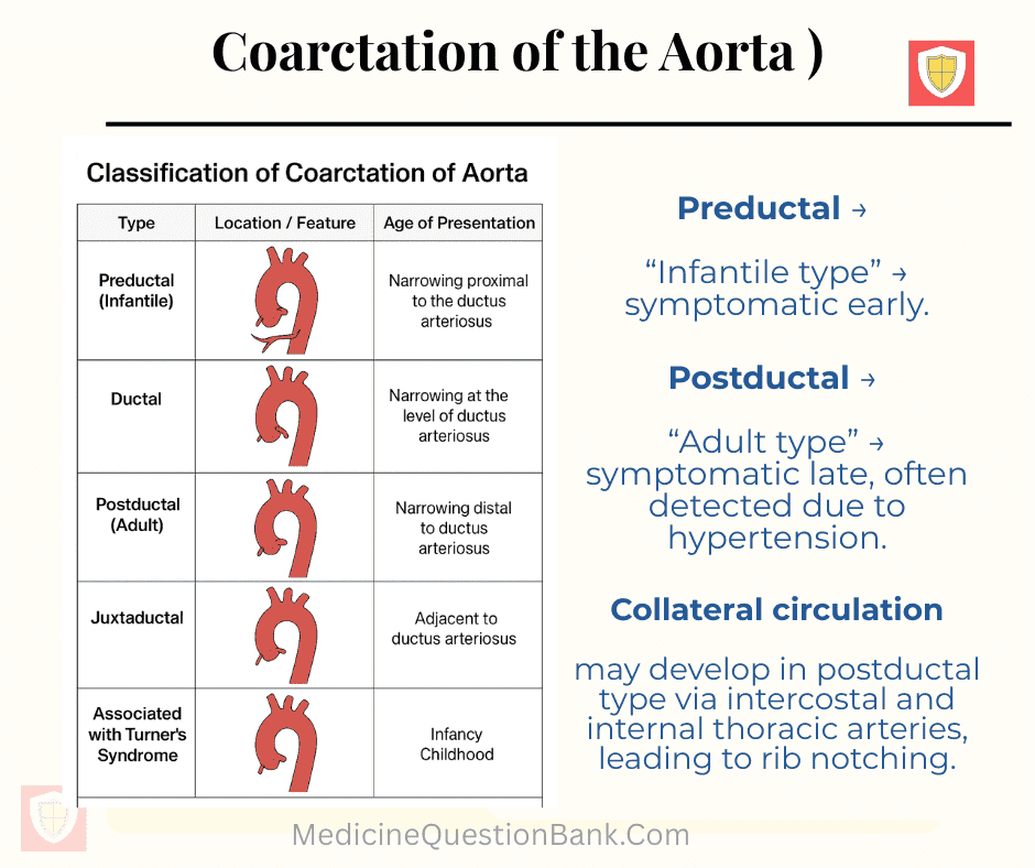Coarctation of the Aorta