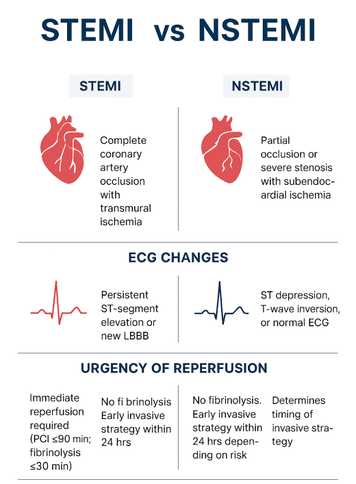 ACS Management Algorithm
