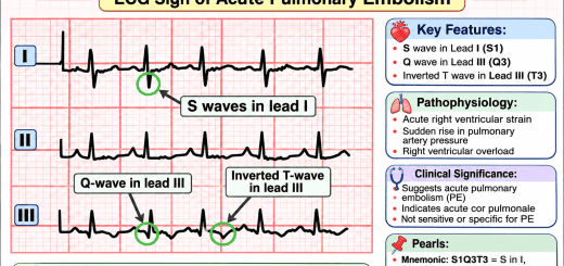 S1Q3T3 Pattern